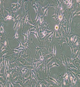 B16-F0小鼠黑色素瘤細胞主圖