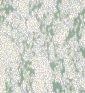 EL-4-B5小鼠胸腺淋巴瘤細胞主圖