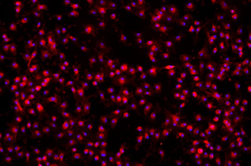小鼠骨髓來(lái)源巨噬細(xì)胞主圖