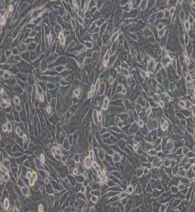 MDA-MB-435S人乳腺癌細(xì)胞/人黑素瘤細(xì)胞(M14污染細(xì)胞系)主圖