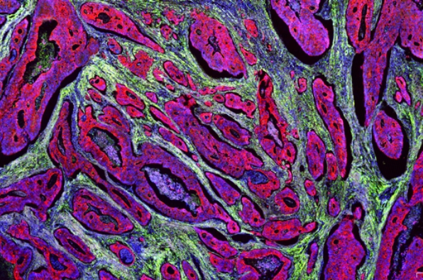切片全景掃描（熒光四標(biāo)五色）主圖