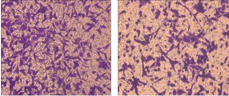 細胞遷移實驗圖